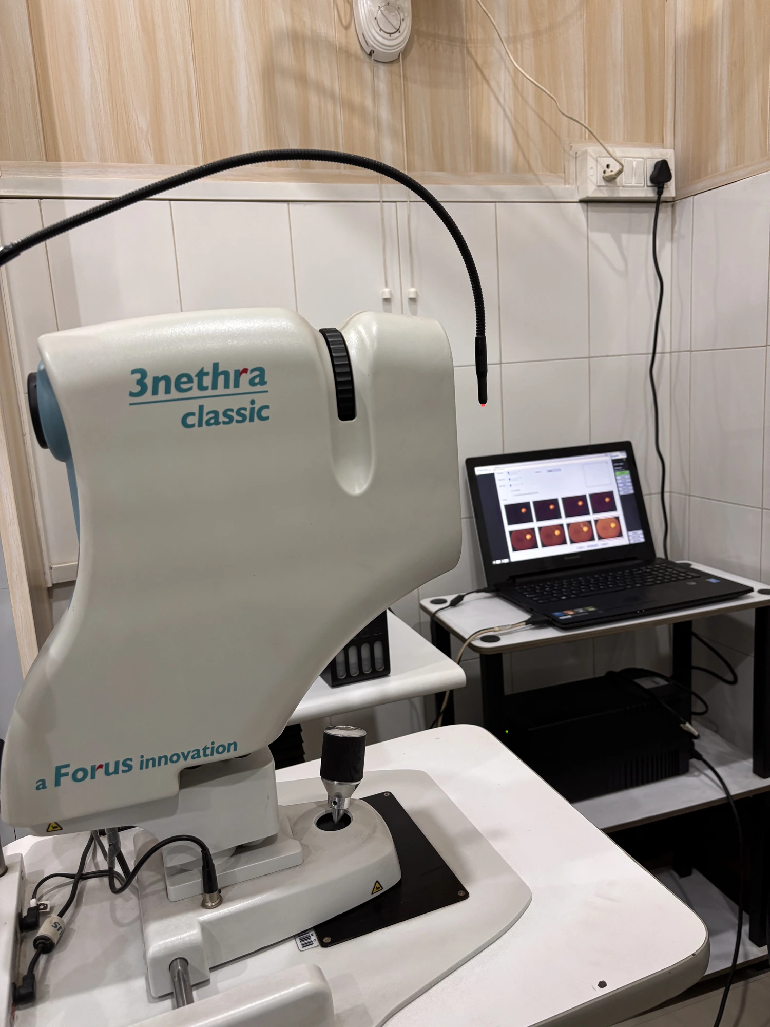 3nethra fundus camera for retina imaging